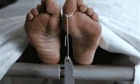 مرگ مرد میانسال زیر تیغ جراحی