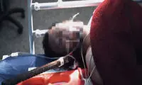 تصاویر هولناک خارج کردن میلگرد از گردن کارگر جوان