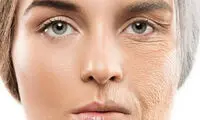 چروک صورت نشانه این بیماری مرگبار است