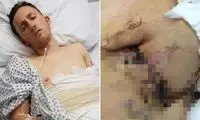پیوند دست به شکم به سبک جنگ جهانی اول آرزوی یک جوان انگلیسی را محقق کرد