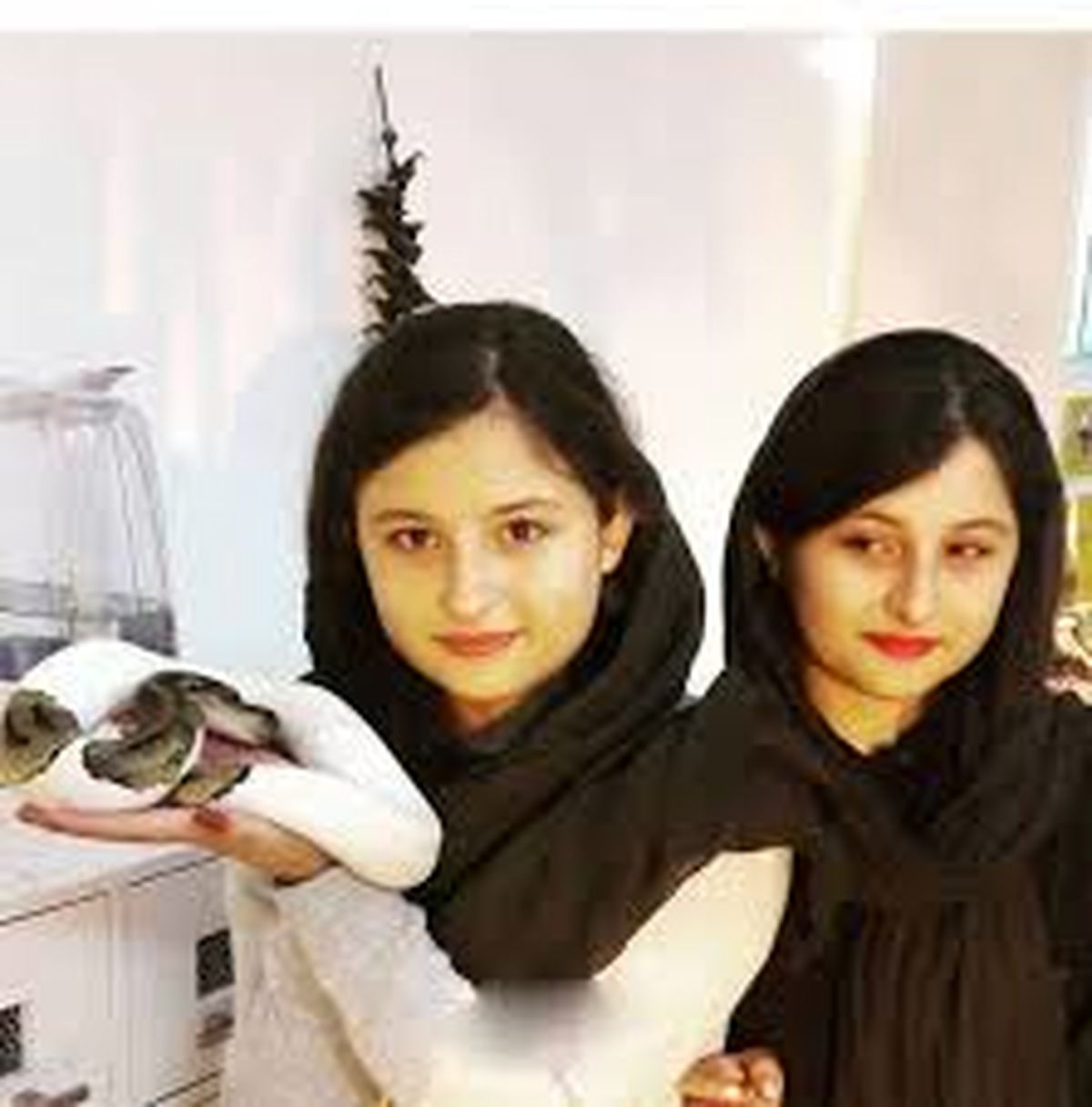 نیکای سریال پایتخت زیر تیغ جراحی رفت