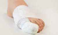 اگر مدام انگشت پایتان با اشیا برخورد می‌کند ...