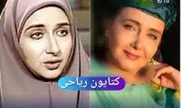 عکس‌های 8 خانم بازیگر ایرانی قبل و بعد از عمل