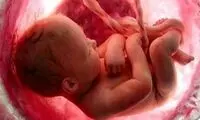 اولین واکنش به خبر گم‌شدن جنین‌ها در بیمارستان آبان