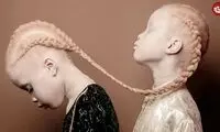 10 کودکی که با ویژگی‌های فرازمینی به دنیا آمدند