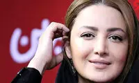 تصویری از شیلا خداداد قبل از عمل زیبایی