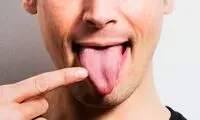 آنچه زبان شما درباره سلامتی‌تان می‌گوید!