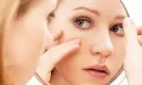 فواید معجزه‌آسای شیر برای سلامت پوست