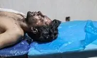 تصاویری تلخ از مصدومان چهارشنبه‌سوری