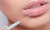 ویدئویی از یک جراحی زیبایی که طی ساعات گذشته وایرال شد