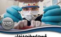 ایمپلنت دندان در دندانپزشکی ایثار: خدمات تخصصی با قیمت‌های مقرون به صرفه