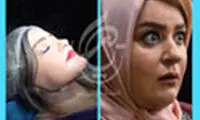 بهترین مراکز ساکشن غبغب در تهران + معرفی 10 مرکز برتر
