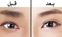 یک ماساژ ساده اما مؤثر برای جوان سازی دور چشم 