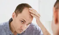 با این ترفند مشخص می‌شود طاس خواهید شد یا نه!