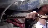 گیتارنوازی باورنکردنی بیمار هنگام جراحی تومور مغزی