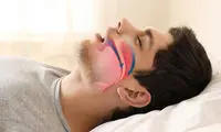 خر‌و‌پف شبانه و افزایش خطر ابتلا به آلزایمر