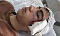 تنبیه ‌بدنی، دانش‌آموزی را در بم راهی بیمارستان کرد
