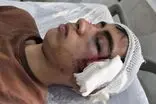 تنبیه ‌بدنی، دانش‌آموزی را در بم راهی بیمارستان کرد