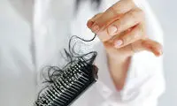این شش دلیل عامل مهم ریزش مو هستند
