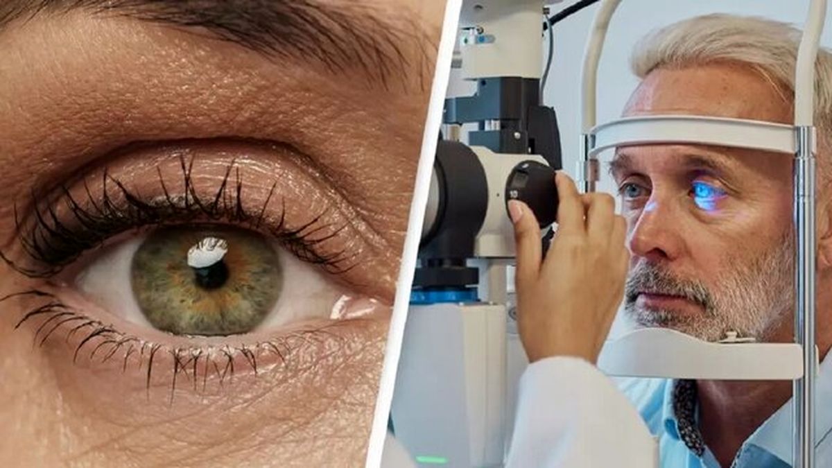 تصویری از کمیابترین رنگ چشم در جهان