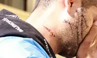 اگر صورت این مرد را ببینید، وحشت‌زده می‌شوید!