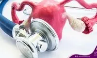 این علائم خبر از چسبندگی رحم می‌دهد