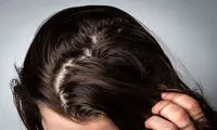 موهای چرب و شامپو مربوطه آن را بشناسید