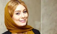 پروتز عجیب لب‌های سحر قریشی سوژه شد 