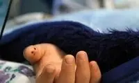 جزئیات مرگ تلخ آیلین کوچولو بر اثر نیش عقرب‌ 
