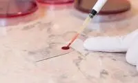راه ساده و ارزان برای تشخیص سرطان‌ها