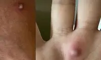 لقب بدشانس‌ترین انسان جهان برازنده این مرد است!