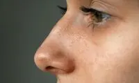 قوز بینی، ترند تازه زیبایی ۲۰۲۶ شد!