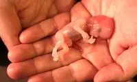 بلایی که کرونا بر سر مغز جنین می‌آورد