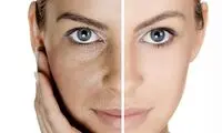 چهار مرحله ساده برای مراقبت از پوست