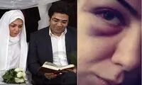 ماجرای یکتا ناصر یاد آزاده نامداری را زنده کرد