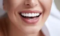 چگونه در خانه دندان‌های زرد را سفید کنیم؟