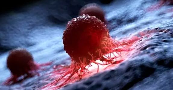 کشف روشی خلاقانه برای نابودی سلول‌های سرطانی