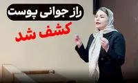 گزارش ویژه؛ صحبت‌های غیرمنتظره یک کارشناس پوست درباره جوانسازی