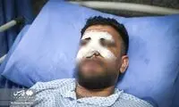 مجروحین یگان ویژه پلیس در اعتراضات اخیر