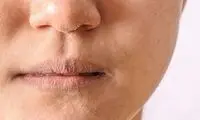 خواص بی‌نظیر این نوع سرکه برای صورت