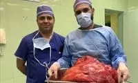 خارج کردن توده ۲۳ کیلویی از شکم خانم تبریزی
