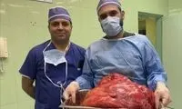 خارج کردن توده ۲۳ کیلویی از شکم خانم تبریزی