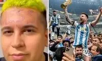 وحشتناک‌ترین تتو با نام مسی روی پیشانی