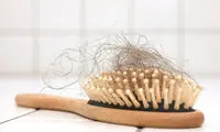 شناسایی 6 بیماری از ظاهر موی سر