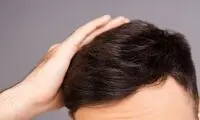 رژیم غذایی فوق‌العاده برای افزایش رشد مو