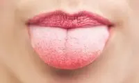وضعیت زبان درباره سلامتی ما چه می‌گوید؟