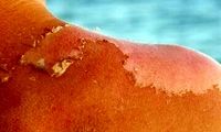 توصیه مهم یک متخصص پوست به زنان