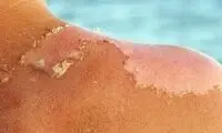 توصیه مهم یک متخصص پوست به زنان