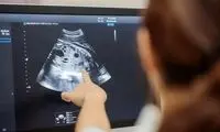 یک اتفاق عجیب بعد از اجرای قانون جوانی جمعیت