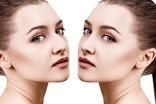 هزینه عمل جراحی بینی در سال 1404 + جدول قیمت